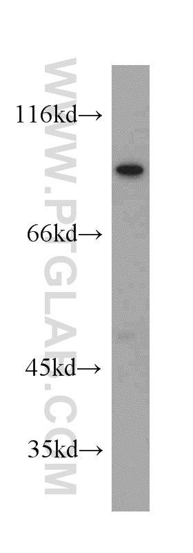 20718-1-AP;mouse brain tissue