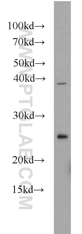 14141-1-AP;mouse liver tissue