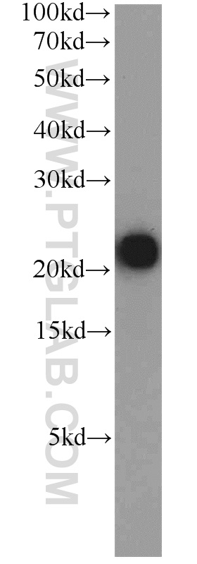 16564-1-AP;human placenta tissue