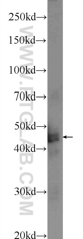 24092-1-AP;mouse brain tissue