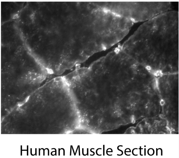 20125-1-AP;human muscle slides