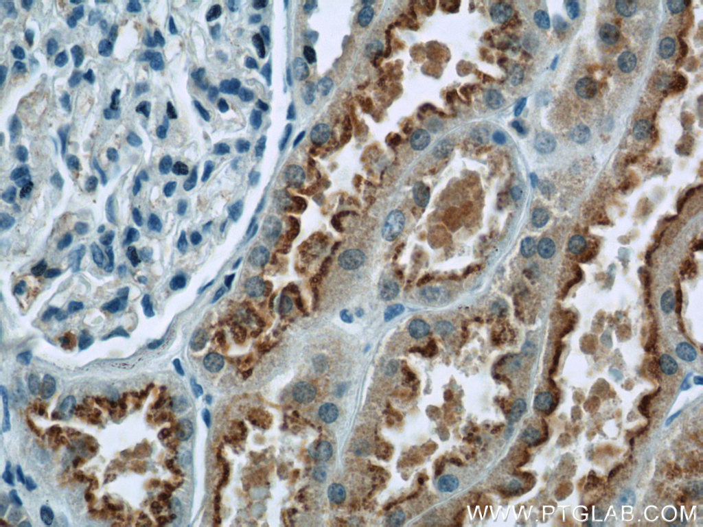 13975-1-AP;human kidney tissue