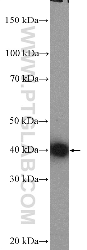 12521-1-AP;Jurkat cells