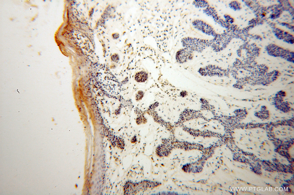 TMPO LAP2 Antibody 14651 1 AP Proteintech