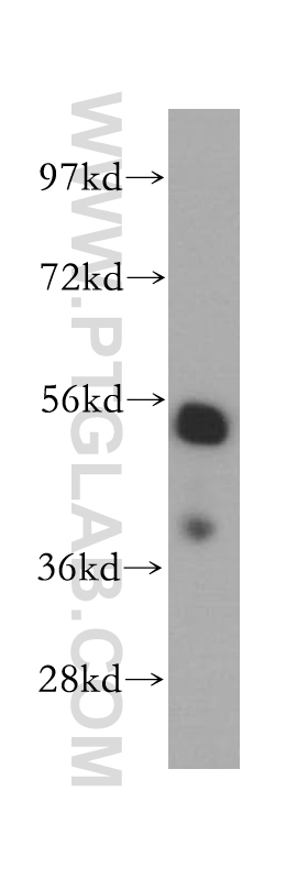 LAP2 Antibody 14651 1 AP Proteintech