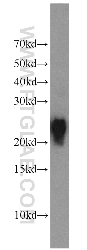 10500-1-AP;HL-60 cells