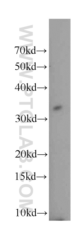 21520-1-AP;K-562 cell