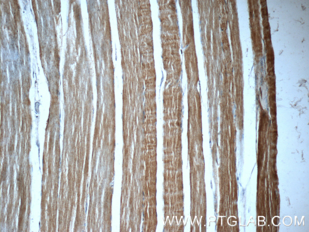 19729-1-AP;human skeletal muscle tissue