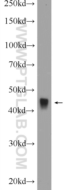 13607-1-AP;rat skeletal muscle tissue