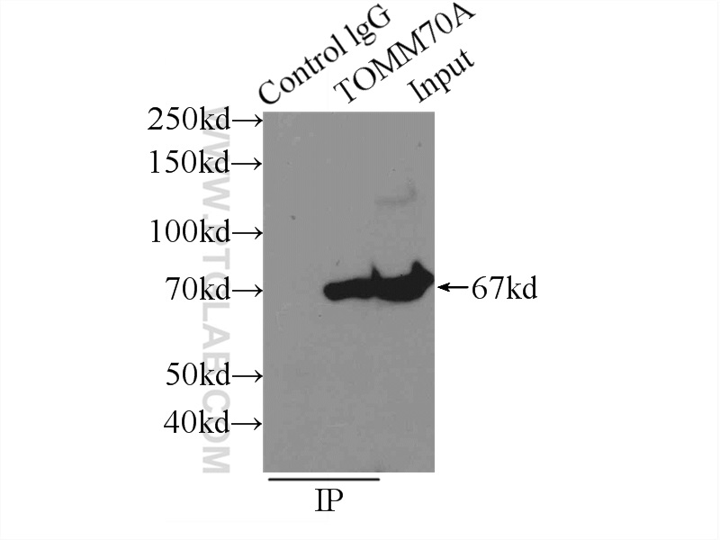 14528-1-AP;mouse brain tissue