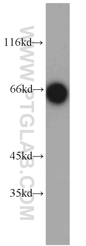 14528-1-AP;mouse liver tissue