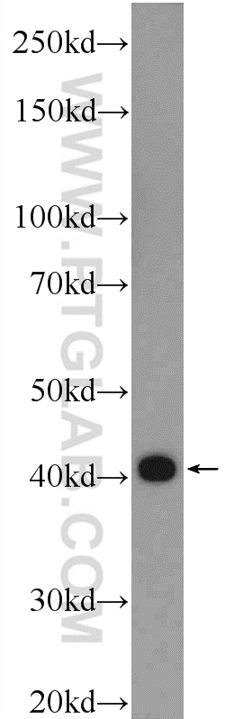 55444-1-AP;mouse skeletal muscle tissue