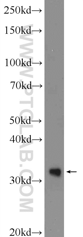 24876-1-AP;HeLa cells