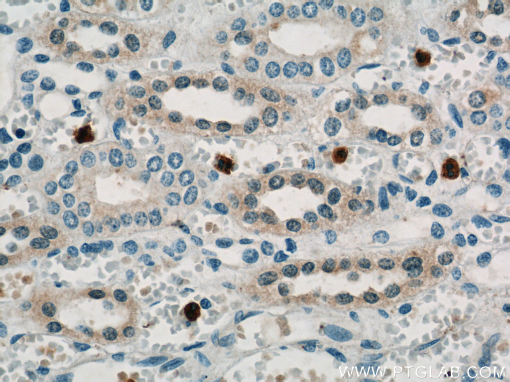 20356-1-AP;human kidney tissue