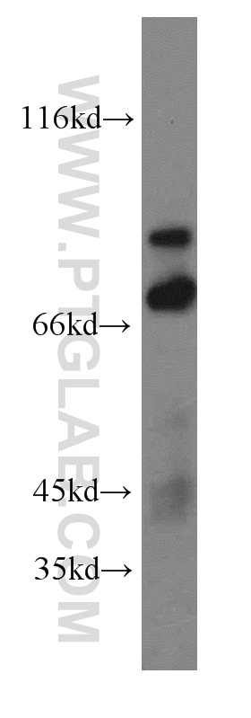 20356-1-AP;mouse small intestine tissue