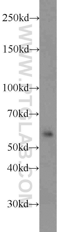 12205-1-AP;Jurkat cells