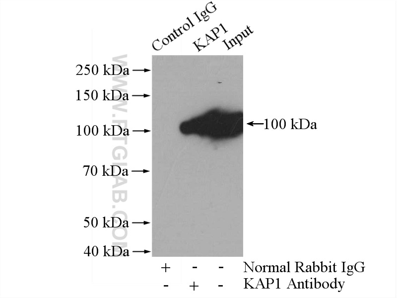 15202-1-AP;HeLa cells