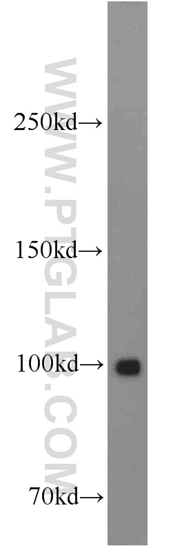 15202-1-AP;HeLa cell