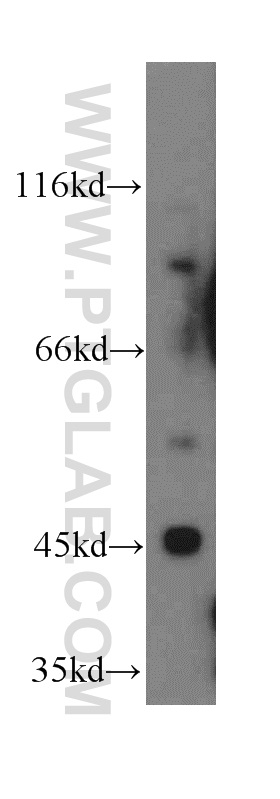 12757-1-AP;mouse brain tissue