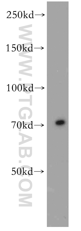 18468-1-AP;BxPC-3 cells