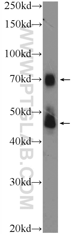 11476-1-AP;MKN-45 cells