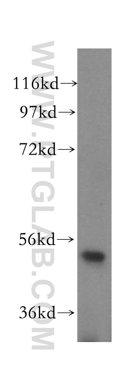 17555-1-AP;mouse uterus tissue