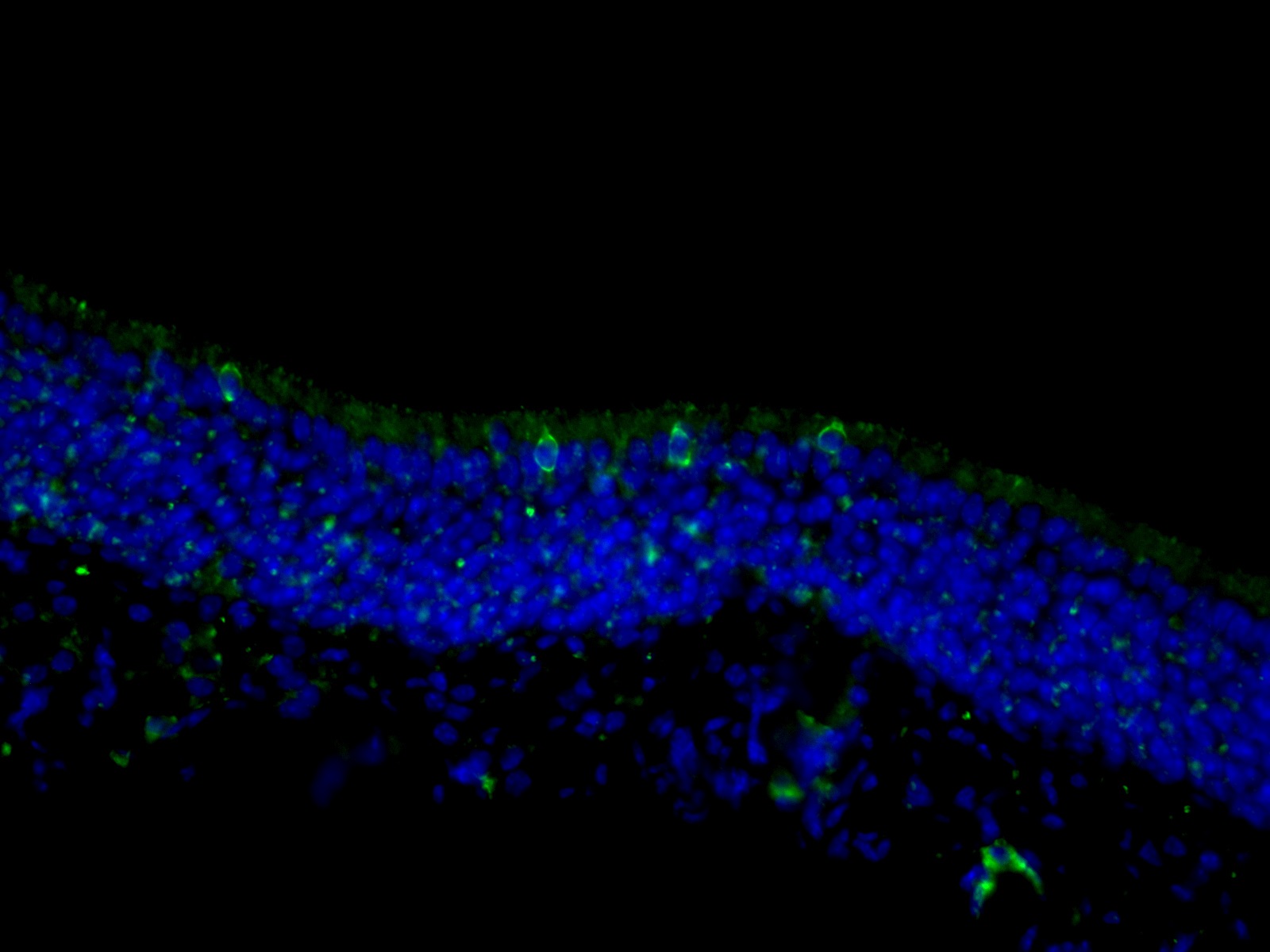 18027-1-AP;mouse olfactory epithelium tissue