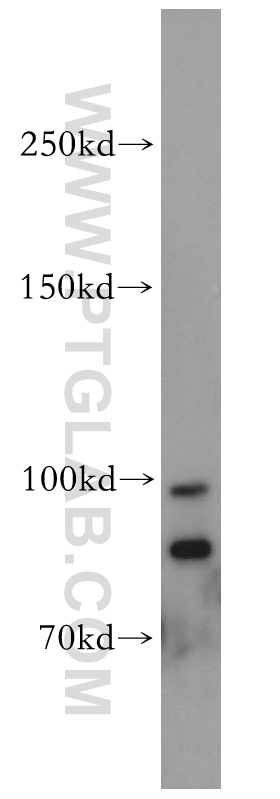 18027-1-AP;mouse colon tissue