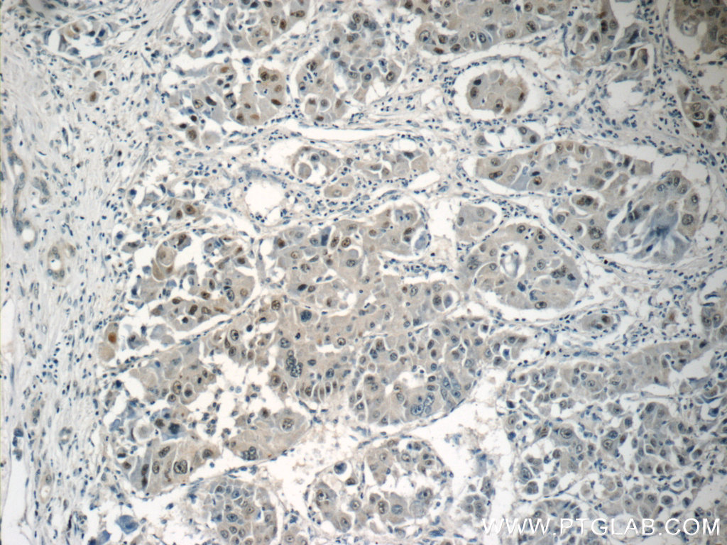 15541-1-AP;human liver cancer tissue