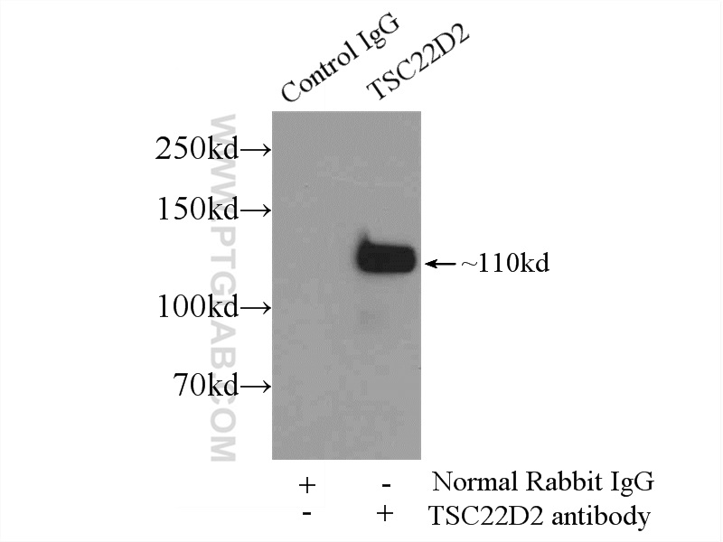 25418-1-AP;HepG2 cells