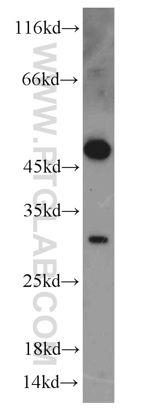 16058-1-AP;HeLa cell