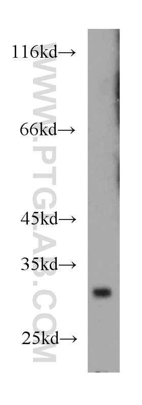 12293-1-AP;mouse colon tissue