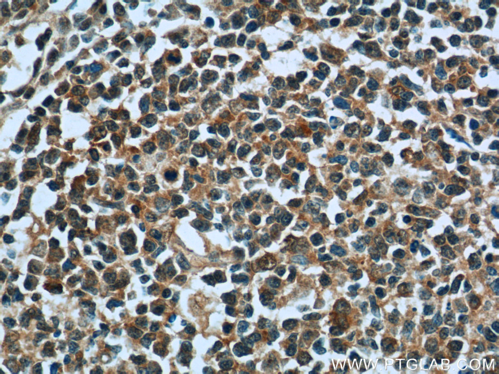 24594-1-AP;human tonsillitis tissue