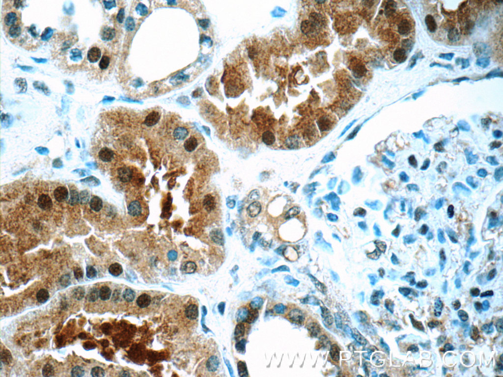 24594-1-AP;human kidney tissue