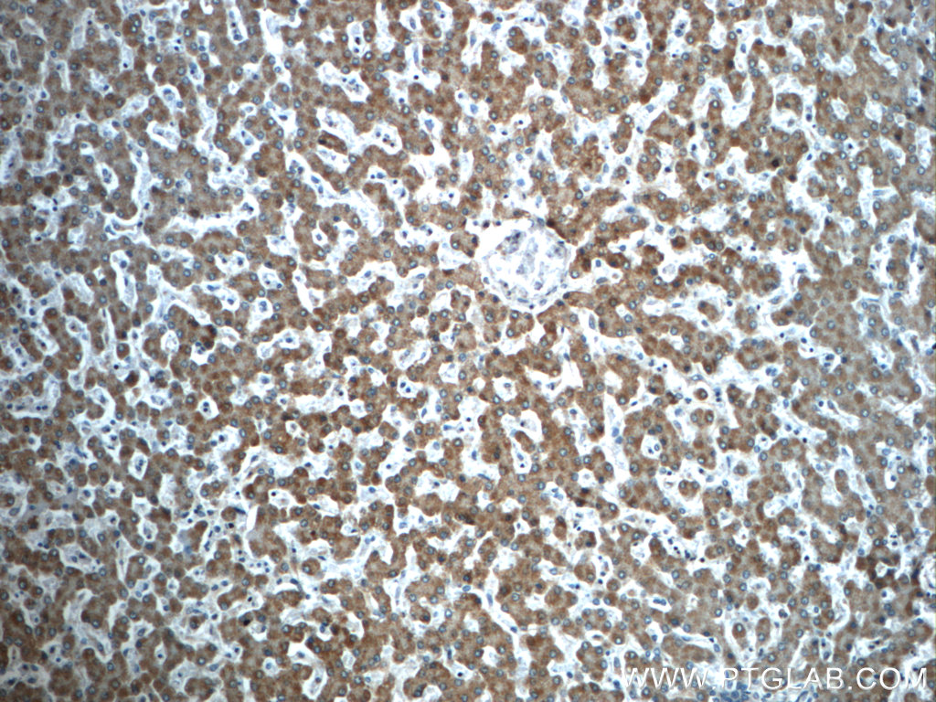 23432-1-AP;human liver tissue