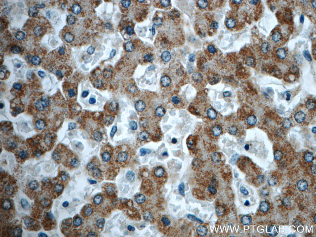 23432-1-AP;human liver tissue