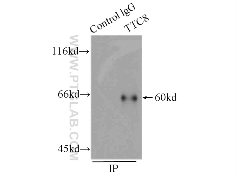 12505-1-AP;HeLa cells