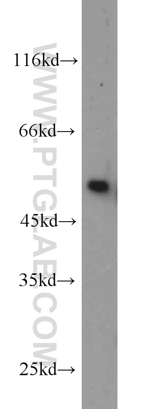 12505-1-AP;mouse testis tissue