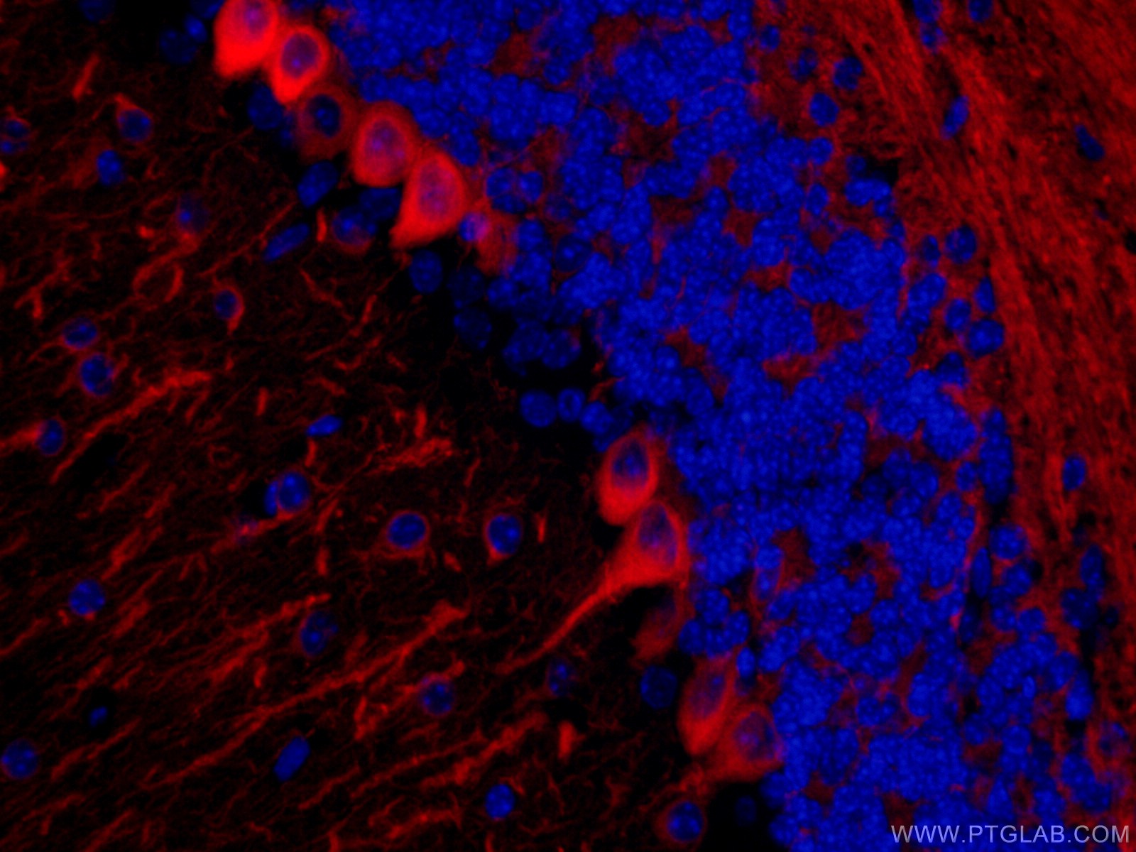 Tubb3 Specific Antibody Cl594 66375 Proteintech