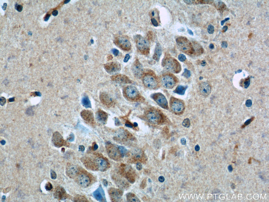 12327-1-AP;mouse brain tissue