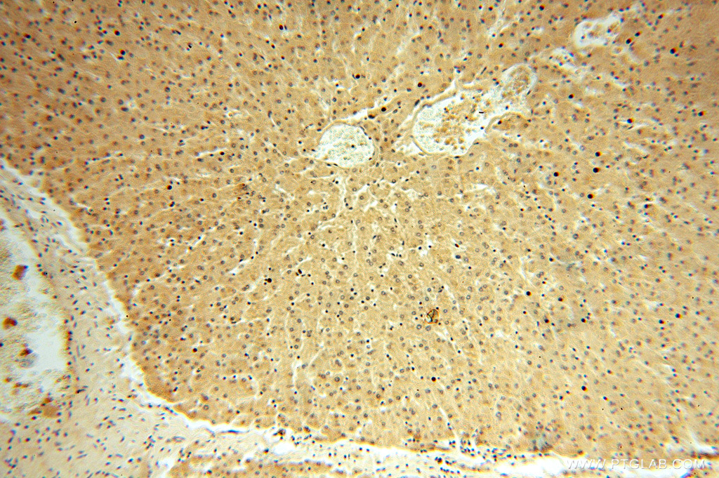 14999-1-AP;human liver