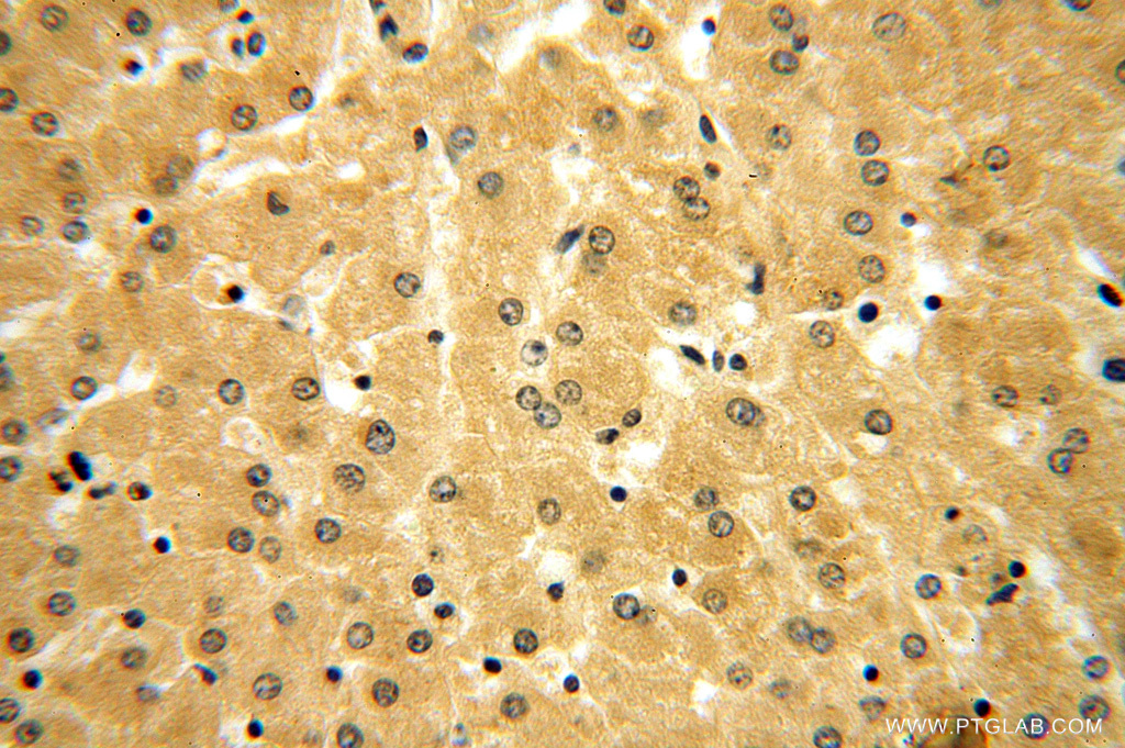 14999-1-AP;human liver