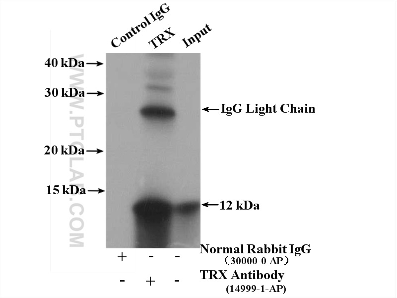 14999-1-AP;Jurkat cells