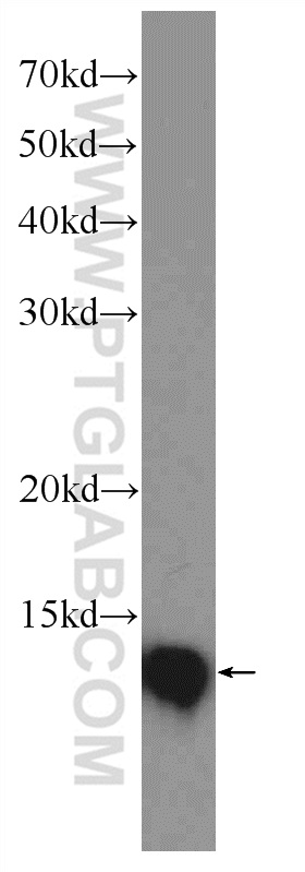 14999-1-AP;Jurkat cells