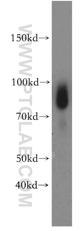 19517-1-AP;human testis tissue