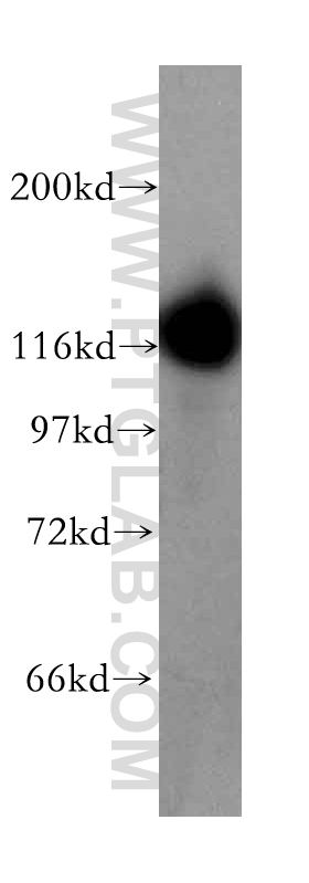 13211-1-AP;human brain tissue