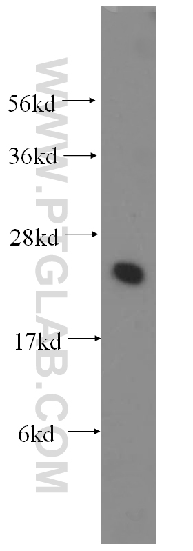 11834-3-AP;human brain tissue