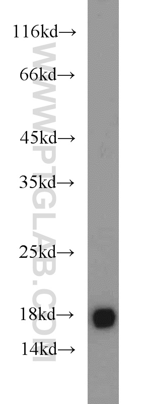 10689-1-AP;HEK-293 cell