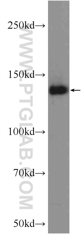 18148-1-AP;HeLa cells