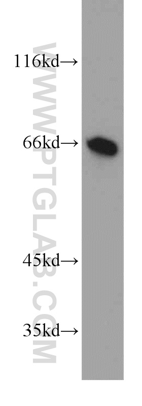 13856-1-AP;human kidney tissue